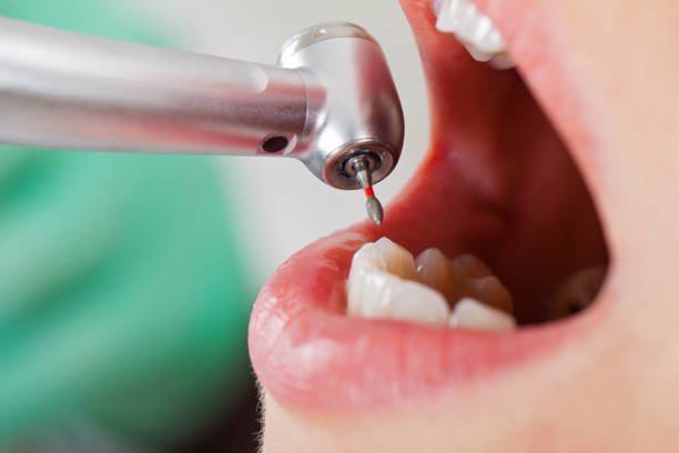 Best Dental Abscess Treatment in New Lisbon, WI